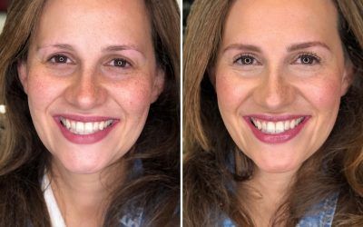 Antes/Después Paloma – Bobbi Brown Lagasca