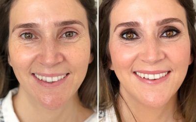 Antes y después Beatriz