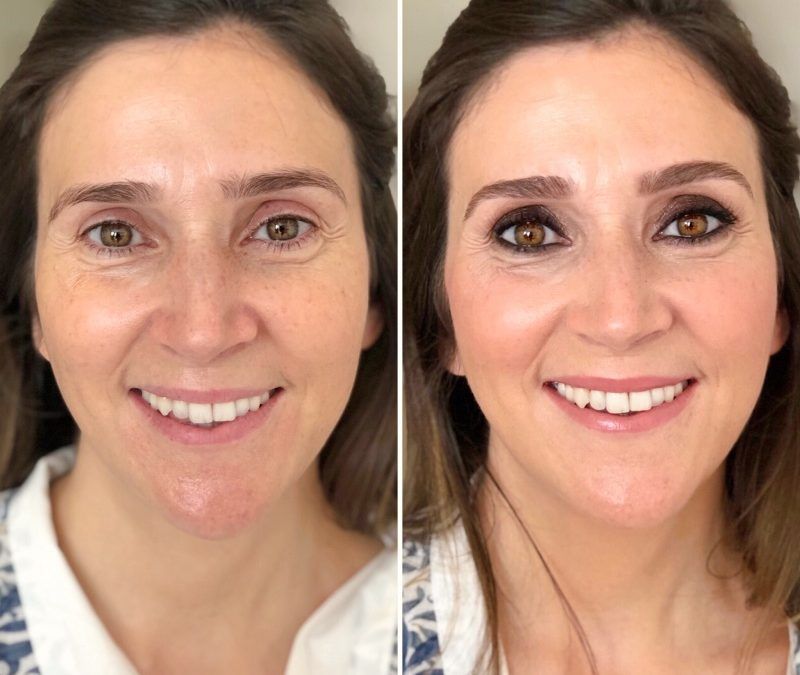 Antes y después Beatriz