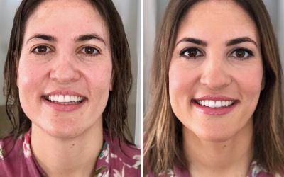 Antes y después a Leticia