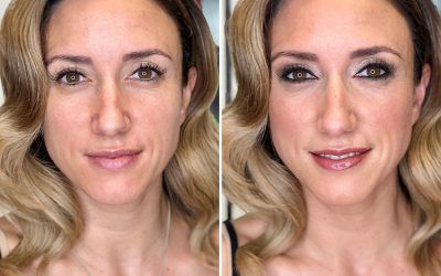 Antes y después Yohanna Alonso